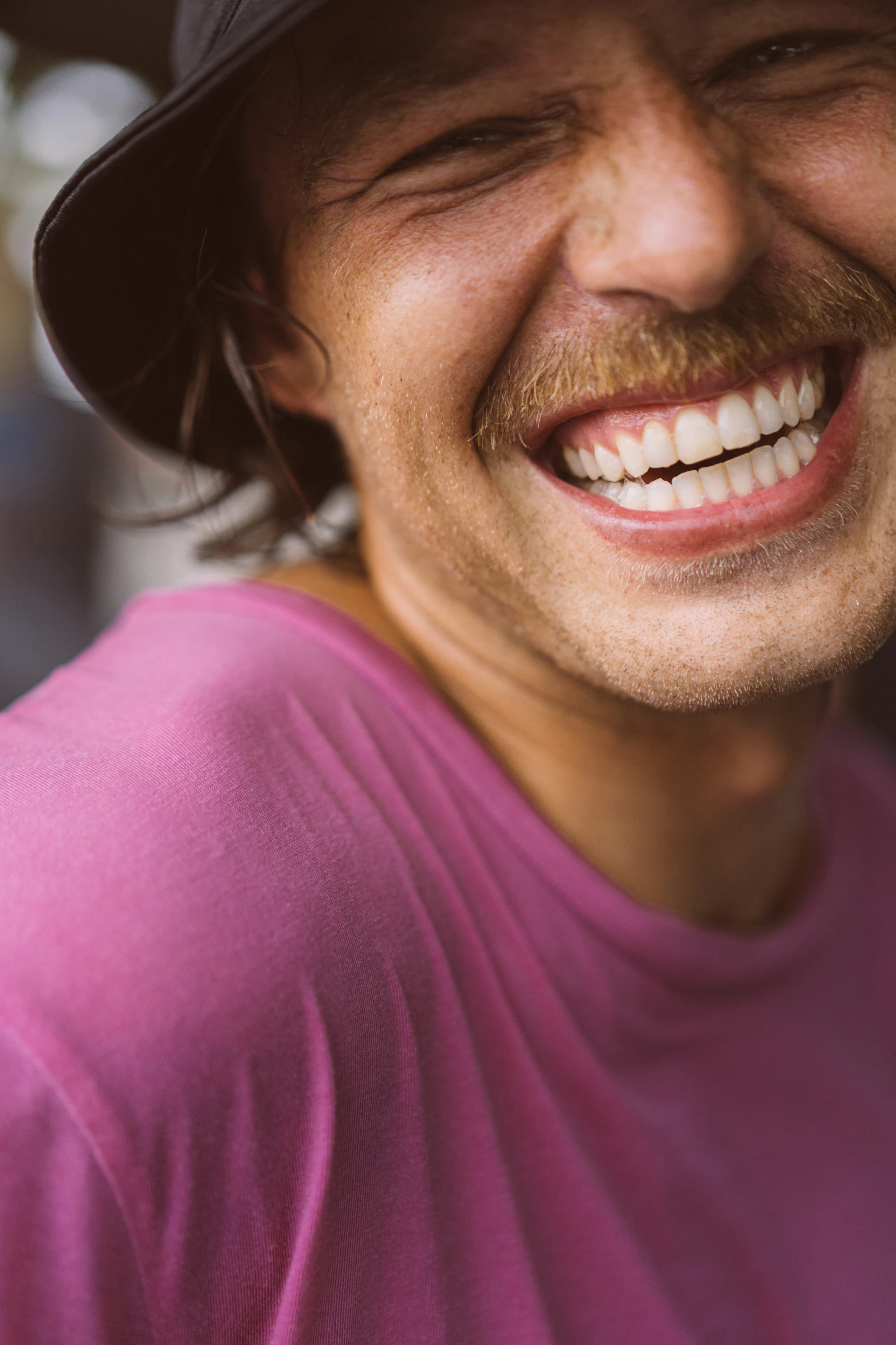 Professional Whitening